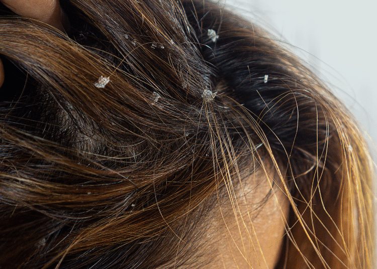 Rahasia Rambut Sehat