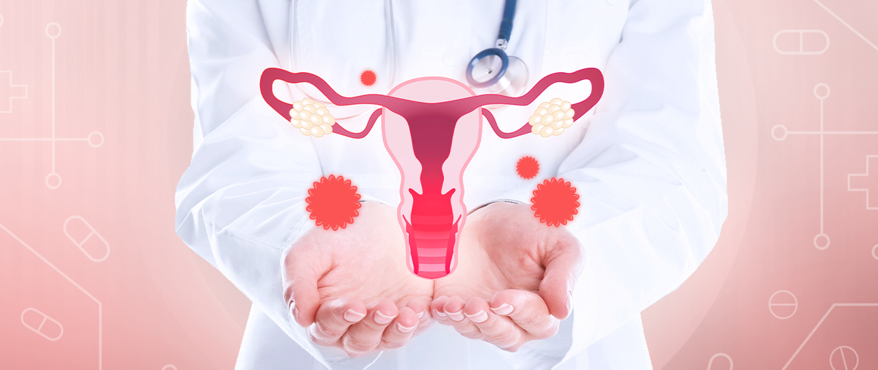 Infeksi Menular Seksual